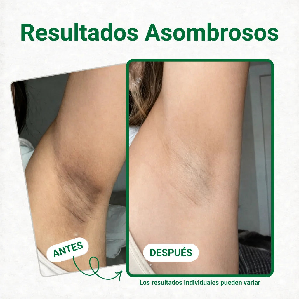 JiYu parches despigmentantes y aclarantes
