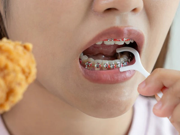 Residuos de alimentos atrapados